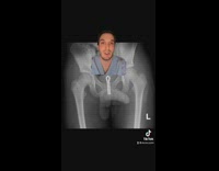 Doctor rants about guys putting beads in urethra