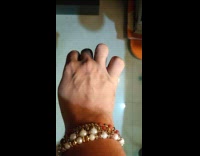 Woman shows vein on back of hand moves