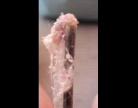 Kid shows spider egg sac on stick