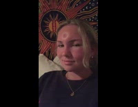 Collab BitchMP - Girl sitting in bed with sunburned face presses finger on forehead leaves dent