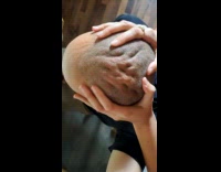 Woman squeeze head of the bald man