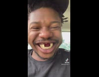 Guy sticks tongue out through missing teeth gap 