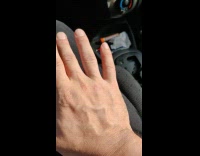 Guy move vein back of hand car