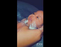 Baby has baby powder in neck rolls