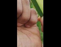 Guy sticks plant spike through finger wart 