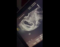 Collab Clips MPUGC - Woman finds out shes having twins 