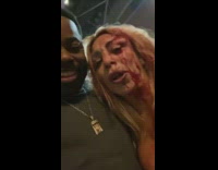 Woman gets into fight for her friend and has blood on face
