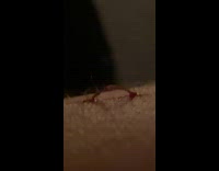 Arm cut wound artery pop out NSFW