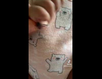 Collab Clips MPUGC - Woman explaining her daugthers extra fingers