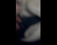 Dog likes to eat his own hair