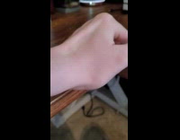 Finger bone elevated at the back of the hand of the filmer