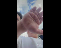 Men with dwarfism in white shirts 