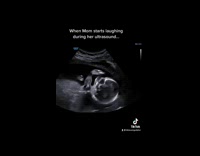 Ultrasound baby inside belly when mom laughs