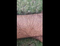 Ant crawl on hair dense arm maze