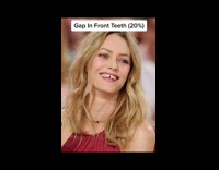 Guy shares stats on rare body features 