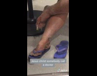 Woman purple sandals has dirty gross feet with long toenails
