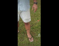 Guy has arrow through calf 