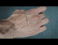Large vein moves inside the hands of the filmer