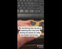 Lady Looks Up and Shows Ripped Contact Lenses