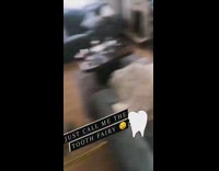 Dad slams door pulls loose tooth out