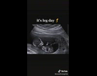 Baby kicks hard inside stomach ultrasound