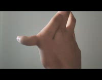 Guy shows extra finger 