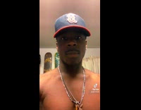 Guy hits shin with skateboard 