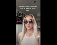 Lady gets picked on for eye size 