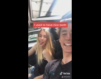 Guy runs into pole cracks front teeth 