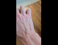 Man moving arteries on hand