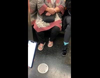 Woman has odd toes curling over big toe