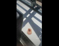 Lady Left Her Synthetic Eyepatch Under Sunlight