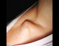 This Does Not Feel Good Man Broken Clavicle