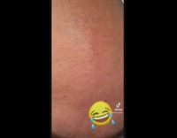 Bald guy has one single long hair needs haircut 